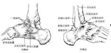 脚踝韧带撕裂图片,图片解析与康复指导